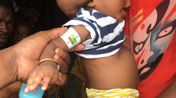Why Iron Deficiency is Holding Back Global Nutrition Goals
